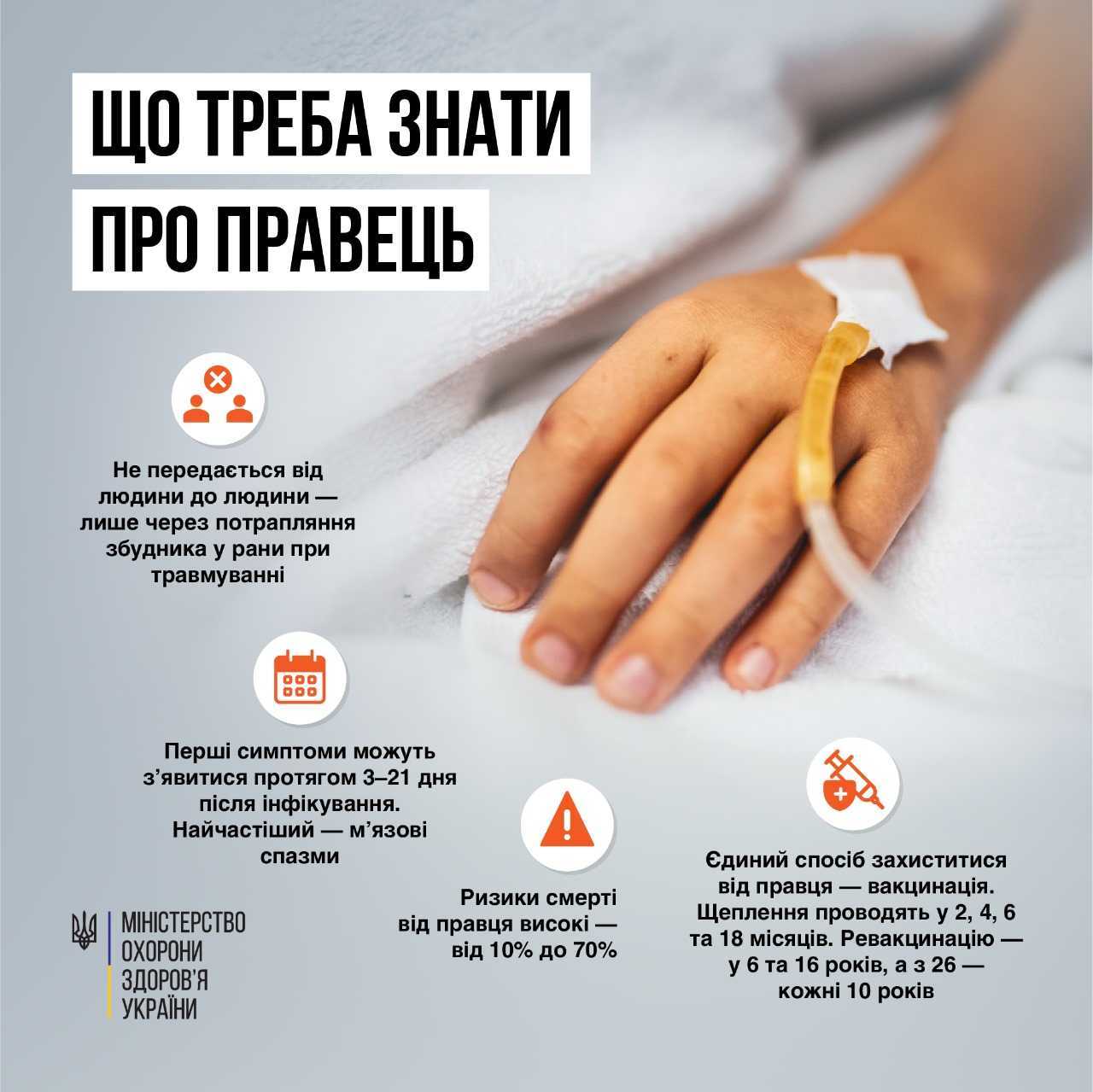 Що треба знати про правець